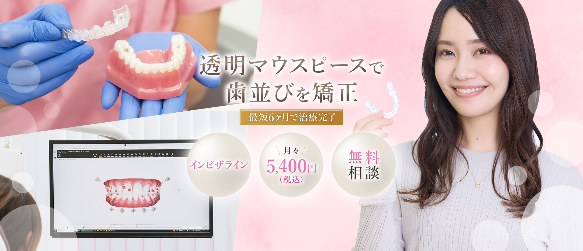 一日橋デンタルクリニック マウスピース矯正専門サイト 透明マウスピースで歯並びを矯正 最短6ヶ月で治療完了