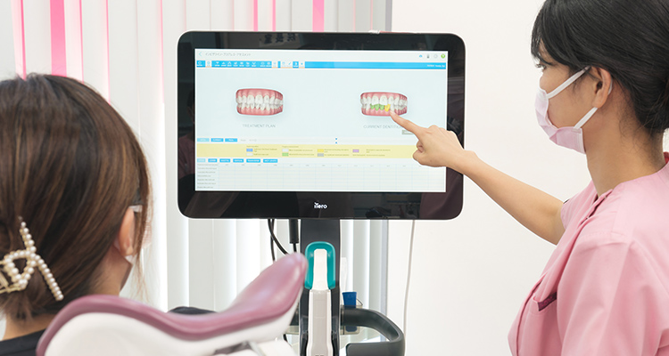 Iteroによる無料の矯正簡易診断